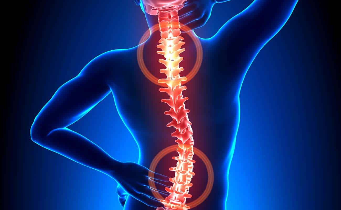 Spinal health importance highlighted with a digital illustration of the human spine and highlighted areas indicating pain or injury.